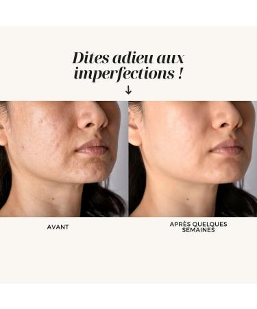  O l na Organic Calendula Maceration Oil Oil for Skin Care (Body & Face) & Hair Moisturizing Natural Oil Massage Oil for Skin Care 100% Natural 50 ml - Buy Online on GoSupps.com