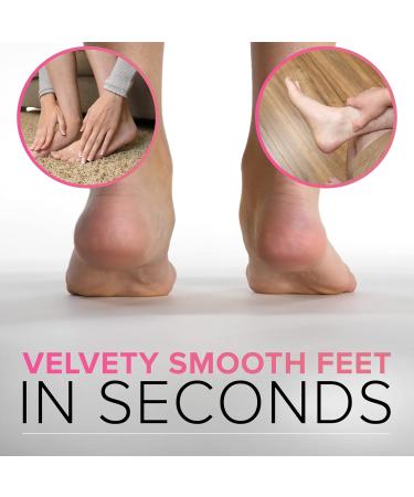 RUSTPROOF Callus Remover for Feet | XL Professional Pedicure Foot File & Spa Products | Effective Wet & Dry Dead Skin Scrubber - Non-Electric Foot Care Kit - Buy Online on GoSupps.com
