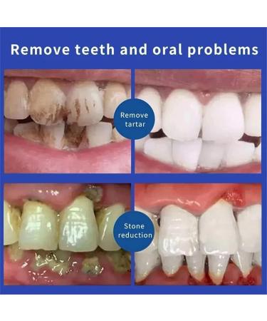 Sp-6 Ultra Whitening Sp 6 Toothpaste Sp - 6 Ultra Whitening Toothpaste Deep Cleaning Care Toothpaste Sp 6 Probiotic Whitening Toothpaste Fresh Breath (Color : 1pcs Blu - Buy Online on GoSupps.com