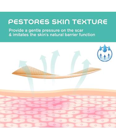 Medical Grade Silicone Tape for Scar Removal - 1'' X 70'' Roll with 5cm Crease, Keloid & Bump Treatment - Easy Tear, Scissor-free - 1 Count - Buy Online on GoSupps.com