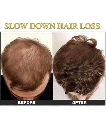 Huile de cheveux Damaged Hair Oil Scalp Oil for Hair Growth Hair Thickening Oil for Men Rollerball Hair Oil for Growth Scalp Oil Hair Moisturizer for Thickening - Buy Online on GoSupps.com