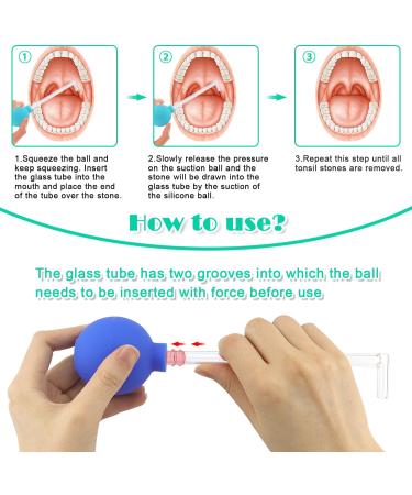 Almond Stones Removal Cupping Glass - Fresh Breath Solution for Tonsil Stones (Blue) - Buy Online on GoSupps.com