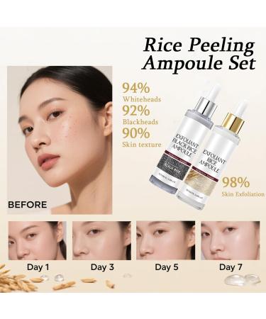 Glow Rice Ampoule Duo - 2PCS White & Black Rice Exfoliant Rice Exfoliator for Face & Body Gentle Peel to Remove Dead Skin & Blackheads Rejuvenating Hydration Rice Ampoule Exfoliant for All Skin Types Black+White 3.38 Fl Oz  - Buy Online on GoSupps.com