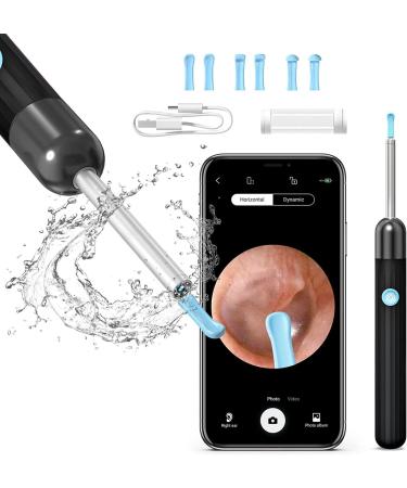 QDCFY Otoscope Ear Camera 1080P HD 3.5mm Ear Cleaning Tool for IOS and Android Smartphones (White) Black
