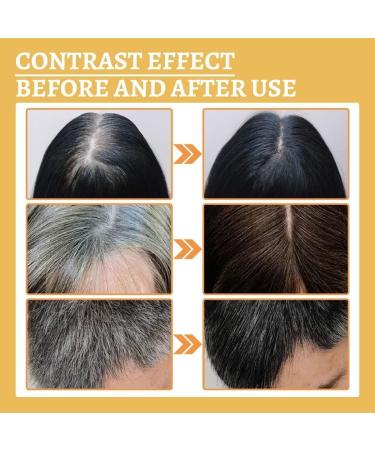 S rum Anti-Cheveux Gris Anti-Greying Hair Serums S rum Pour Cheveux Gris Huile Capillaire R paratrice Serum Cheveux Natural Hair Darkening Serum Natural Ganoderma Hair Oil (3) - Buy Online on GoSupps.com