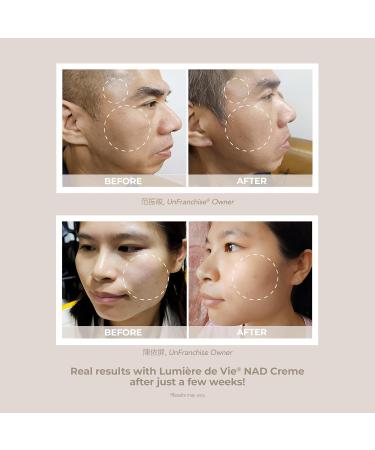LUMI RE DE VIE NAD Cr me Face Cream with 5% Myristyl Nicotinate, Supports Healthy NAD Levels, Smooths the Look of Fine Lines, Helps Improve Elasticity & Hydration, 40g - Buy Online on GoSupps.com