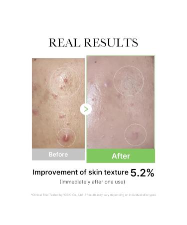 Medicube Exosome Cica Tea Tree Ampoule for Sensitive Skin with Centella Asiatica help reduce redness and breakouts. Low-irritating Moisturizing & Soothing Serum | Korean Skincare | 30ml - Buy Online on GoSupps.com