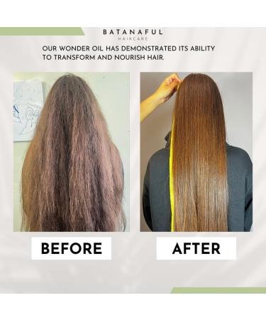 Batanaful Wonder Hair Oil for Dry Damaged Hair Regrowth Treatment Batana and Rosemary Oil for Hair Growth Oil for Skin Care - 150 ml - Buy Online on GoSupps.com