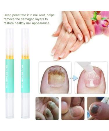 Nail Repair Pen Serum - 2pcs for Home & Salon Use | Daily Nail & Cuticle Care - Buy Online on GoSupps.com
