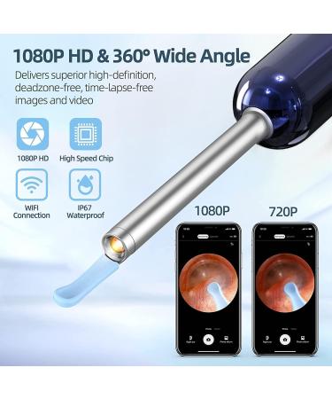 Ear Wax Removal Kit with 1080P Camera and 6 Ear Picks - Blue | For iPhone, iPad, Android | Otoscope with Light - Ear Cleaner for Effective Cleaning - Buy Online on GoSupps.com
