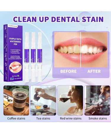 3-Piece Teeth Whitening Pen Set | Fast & Pain-Free Mint Taste Tooth Whitener - Buy Online on GoSupps.com