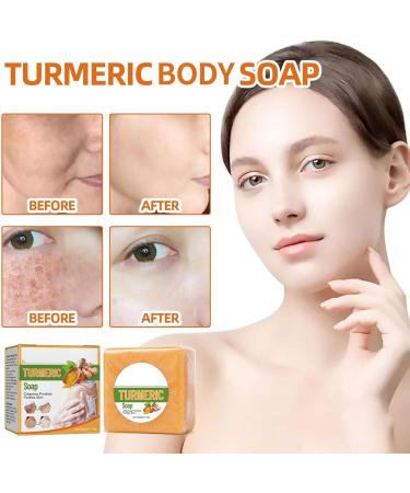 Nmbol Skin Turmeric Soap Cojic Acid Soap For Skin Lightening Kurkuma Soap Lightening Solid Facial Soap Handmade Organic Natural Soap Soap For Dark Spots Hyperpigmentation Smooth Skin - Buy Online on GoSupps.com