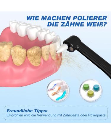 Teeth Whitening Kit HOTOIQ Electric 4 Modes Teeth Whitening Polishes After Cleaning for Teeth Cleaning and Whitening - Buy Online on GoSupps.com