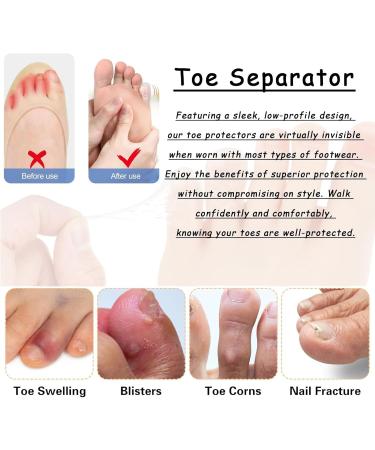 Silicone Anti-Friction Toe Protectors - 10pcs Breathable Gel Covers for Men & Women | Cushions Blisters & Protects Toes - Buy Online on GoSupps.com