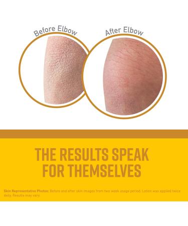 O'Keeffe's R paration de la peau Lotion pour le corps et la peau s che Hydratant Tube 7 onces (pack de 2) - Buy Online on GoSupps.com