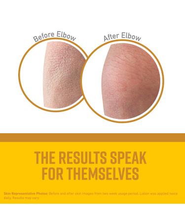 O'Keeffe's Skin Repair Body Lotion 12 oz - Dry Skin Moisturizer Pump Bottle - 1 Pack - Buy Online on GoSupps.com