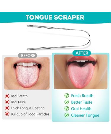 EZ Cozy Tongue Scraper 2 Pack | Stainless Steel Metal Tongue Cleaner for Adults | Reduce Bad Breath & Enhance Oral Care | Easy-to-Use U-Shape Design with Case - Buy Online on GoSupps.com