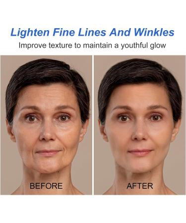 Boto-xface Stock Solution Facial Serum Boto-xface Face Cream Anti Aging Serum for Face Collagen Boost Anti-Aging Serum Face Tightening Serum Boto-xface Injections Reduce Fine Lines - Buy Online on GoSupps.com