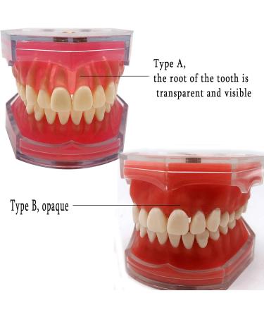Standard Dental Teeth Model - Removable Full Mouth Resin Crown Model for Tooth Extraction & Patient Explanation - Buy Online on GoSupps.com