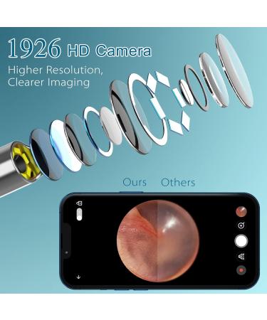 Ear Wax Removal Kit with 1920P HD Camera - Ear Cleaner for iPhone, iPad, Android Phones - 8 Pcs Ear Set - Black - Buy Online on GoSupps.com