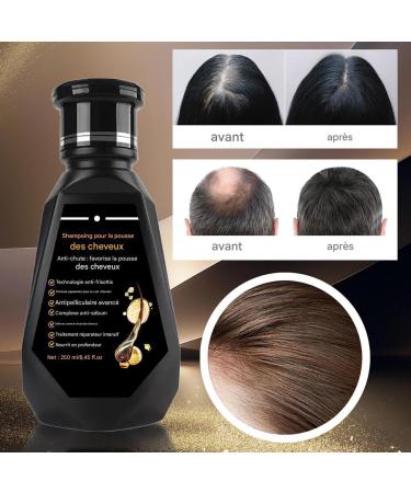 Shampoo For Fine Hair | 250ml Shampoo Strengthening Hair Growth For Men | Natural Deep Cleansing Conditioning - Boosted Volume - Buy Online on GoSupps.com