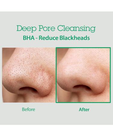BLITHE AHA BHA Cleanser - Deep Pore Cleanser & Exfoliant for Clogged Pores | 5.07 Fl Oz | International Shipping Available - Buy Online on GoSupps.com