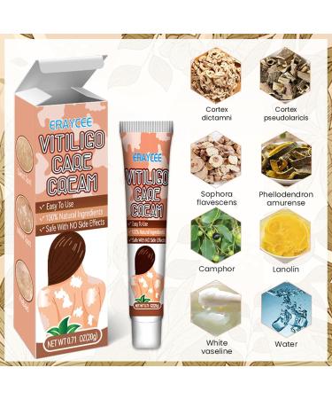  Hongjingda Skin lightening cream for vitiligo - 20g vitiligo relief cream for white patches on the skin reduces white patches improves epidermal melanocytes Hongjingda - Buy Online on GoSupps.com