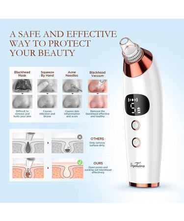 Blackhead Remover Vacuum Pore Cleaner with 5 Suction Power & 5 Probes - Electric USB Rechargeable Extractor for Facial Acne, Whitehead, and Comedone Removal - Includes Hot Compress & 3 Beauty Lamps - Siyaluens Model2 - Buy Online on GoSupps.com