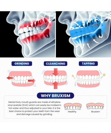 Professional Moldable Mouth Guard for Teeth Grinding - 2 Sizes, 4 Pieces Set - Night Guard for Bruxism & Clenching - Antibacterial Dental Guard Case Included - Buy Online on GoSupps.com