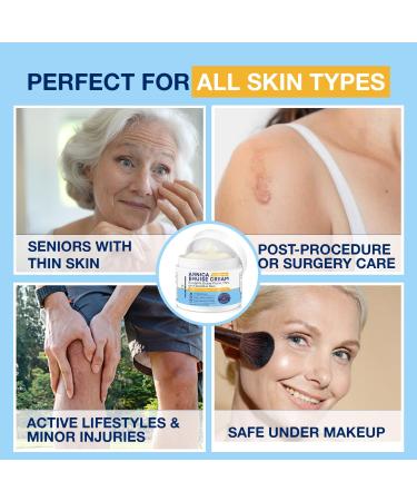 Arnica Bruise Cream Extra Strength Fast-Acting Arnica Montana with Vitamins K C & E for Bruising Swelling Discoloration & Thin Skin Hydrating Moisturizer for Face & Body 4 oz 4 Ounce (Pack of 1) - Buy Online on GoSupps.com
