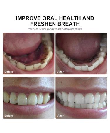 Natural Coconut Oil Mundwood Oral Flushing - Fresh Breath Tooth Whitening & Healthy Gums Mouthwash 60ml - Buy Online on GoSupps.com