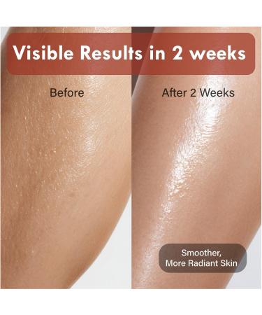 OHMIA Korean Red Bean Body Lotion - 24-Hour Hydrating Moisturizer for Dry Skin with Peptides & Hyaluronic Acid for Smooth Sensitive Skin Women & Men - Vegan & Cruelty-Free - 8.45 fl oz - Buy Online on GoSupps.com