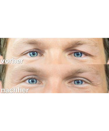 Slue Pflid Tape - Eye Lifting Adhesive Strips | Waterproof 24-Hour Hold | Tast Package S M L - Buy Online on GoSupps.com