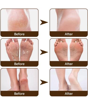 Dry Creme and Damage Creme Repairing Feet Cream Anti-Tearing for Winter Feet Anti-Crack Anti-Crack Anti-Calluses for Heel Feet 15 g - Buy Online on GoSupps.com