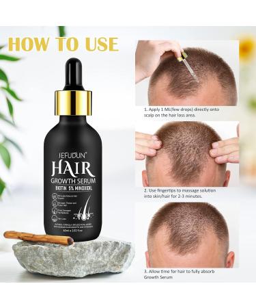5% Minoxidil Hair Growth Oil for Men & Women | Stronger Thicker & Healthier Hair Regrowth Serum | Natural Nourishing Hair Oil | Moisturizes Scalp & Hair - 2.02 oz - Buy Online on GoSupps.com