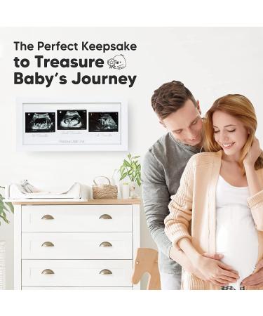 Sonogram Picture Frame Trio - Ultrasound Frames for Mom to Be - Baby Nursery Decor - Pregnancy Announcement Gift - Pregnant Mom Gifts (Alpine White) - Buy Online on GoSupps.com