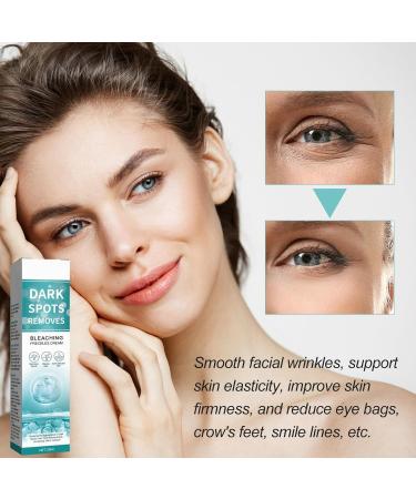 Fade Stain Beauty Cream Freckle Remover Cream Dark Spot Remover for Face Dark Spot Correcting Glow Serum Dark Spots Remover Dark Spot Corrector Cream Age Spot Remover Dark Spot Cream Spot Remover - Buy Online on GoSupps.com