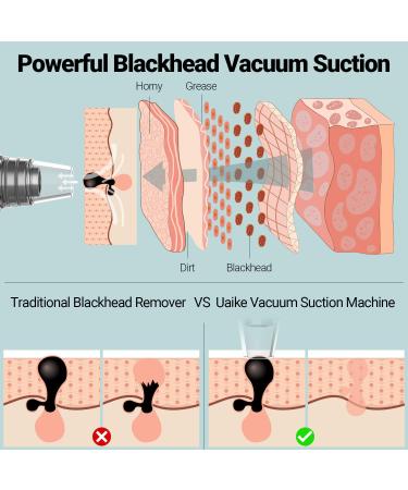 Uaike Blackhead Remover Pore Vacuum Cleaner - Electric Facial Ion Extractor with 5 Suction Power Levels and Probes for Hot and Cold Skin Care - Women and Men - Buy Online on GoSupps.com