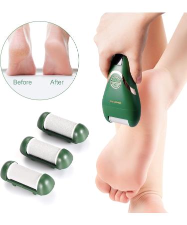SHORAN Electric Foot File- Professional Callus Remover for Pedicure Foot Care - White Roller Included - Buy Online on GoSupps.com