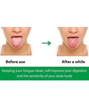 Wonder Care 100% Copper Tongue Scraper - Ayurvedic Anti-Bacterial Oral Hygiene Tool (Pack of 3) - Buy Online on GoSupps.com