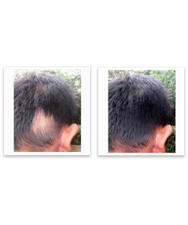 Caboki 10X Volumizing Hair Powder - Talc-Free Dark Gray | Root Touch Up for Thinning Hair | Cover Bald Spots for Men & Women - Buy Online on GoSupps.com