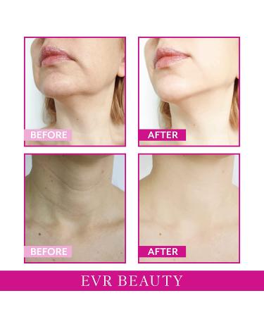 EVR BEAUTY Anti Aging Neck Firming Cream with Collagen & Hyaluronic Acid - Hibiscus & Honey Formula for Sagging Skin, Wrinkles, Double Chin - 4oz - Buy Online on GoSupps.com