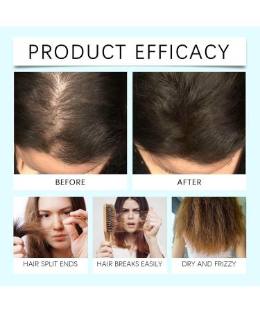  YOENBG Hair Serum Copper Peptide Light Oil for Hair Growth Promoting Hair Regrowth Thicker Stronger for Women and Men (5) - Buy Online on GoSupps.com