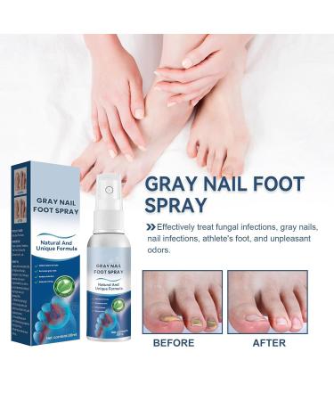 3 Pcs Furzero Athletes Foot & Nail Treatment Spray - Medical Grade Anti-Fungal Formula for Foot & Nail Fungus - Nail Repair Spray - Buy Online on GoSupps.com