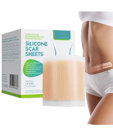 Scar Removal Tape | Soft Silicone Scar Sheets | Silicone Scar Leaves Effective Removal of Beauty Scar Waterproof Skin Tone Repair Tape for Softening and Flattening Scars Edcb 1.5 Million