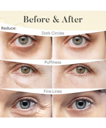 24K Gold Eye Mask - 30 Pairs for Dark Circles & Puffy Eyes | Under Eye Patches & Eye Care Treatment - Buy Online on GoSupps.com