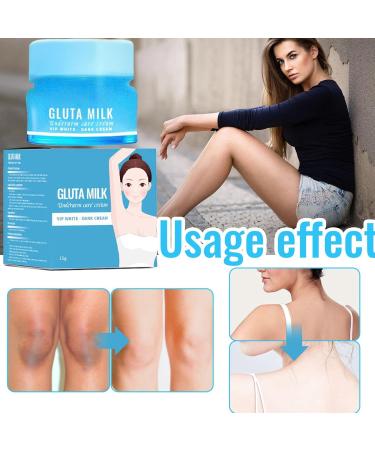 Skin Whitening Creams Intimate Whitening Cream Dark Skin Lightener Skins Lightening Lotion Intimate Area Whitener Perfect and Suitable Beauty Tool for Women - Buy Online on GoSupps.com