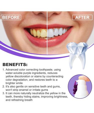 3 Pieces Tooth Whitening Toothpaste Set - Stubborn Spot Treatment Refreshing Breath Brightening Mousse for a Radiant Smile | International Shipping - Buy Online on GoSupps.com