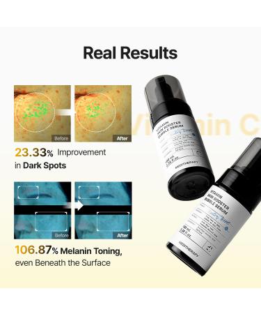 MEDITHERAPY Vitamin Skin Booster Bubble Serum Non-Irritating Gentle Daily Brightening with 2% Vitamin C Derivative Deep Absorbing Micro-Bubble Formula No-Sting Non-Sticky AM/PM Use 100ml - Buy Online on GoSupps.com