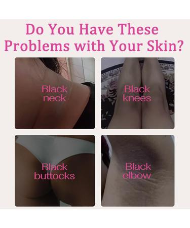 Underarm Evens Skin Tone Cream - Kojic Acid Underarm Products - Skincare Armpit Cream for Dark Skin - Underarm Care Cream - Body Cream for Dark Skin - Improve Skin and Reduce Odor - Buy Online on GoSupps.com